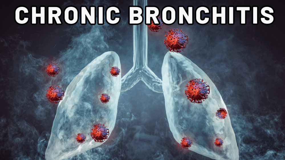 What is Chronic Bronchitis? A Guide for 2025